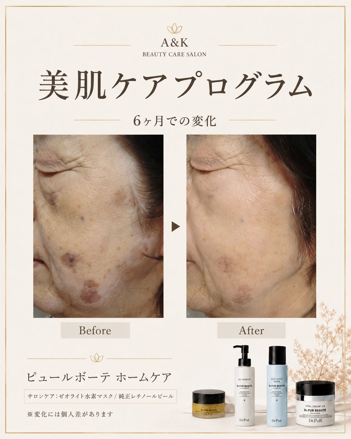 〜年齢を重ねた肌も、毎日のケアでここまで変わる〜